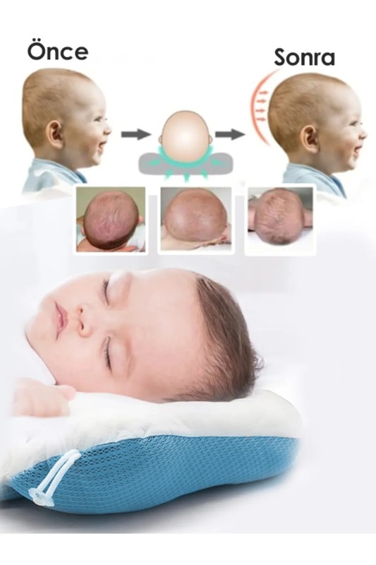 Adjustable Baby Head Support Pillow - Newborn Pillow for Preventing Flat Head Syndrome and Promoting Comfortable Sleep